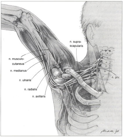 Zenuwletsel bij schouderluxaties 