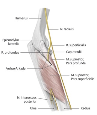 radiaal tunnel syndroom anatomie