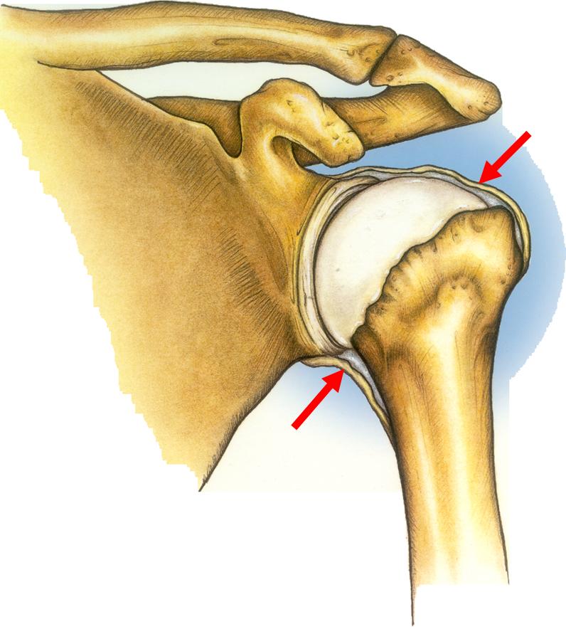 frozenshouldercapsula""